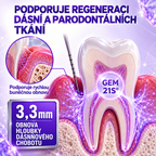 Pasta do zębów Ceoerty®🦷 do leczenia stanów zapalnych dziąseł i przyzębia