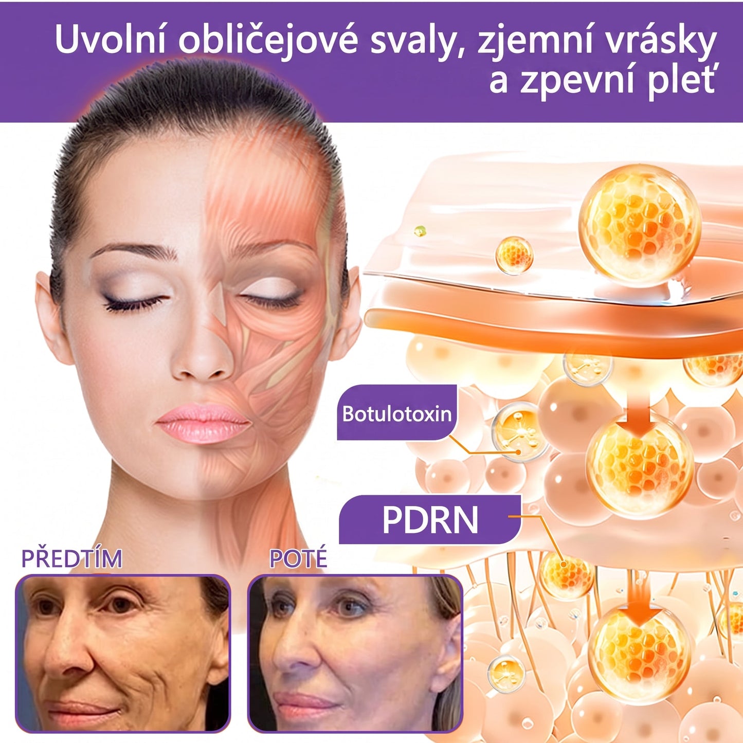 Doporučováno dermatology🥇 | 🍗𝐋𝐮𝐦𝐨𝐫𝐢𝐞® PDRN Multi-Peptidový masážní tělový krém – Proti stárnutí, hydratační, zpevňující, regenerační, sjednocující, proti akné a skvrnám, na odstraňování bradavic a mateřských znamének, pro úlevu při lupénce.❤️
