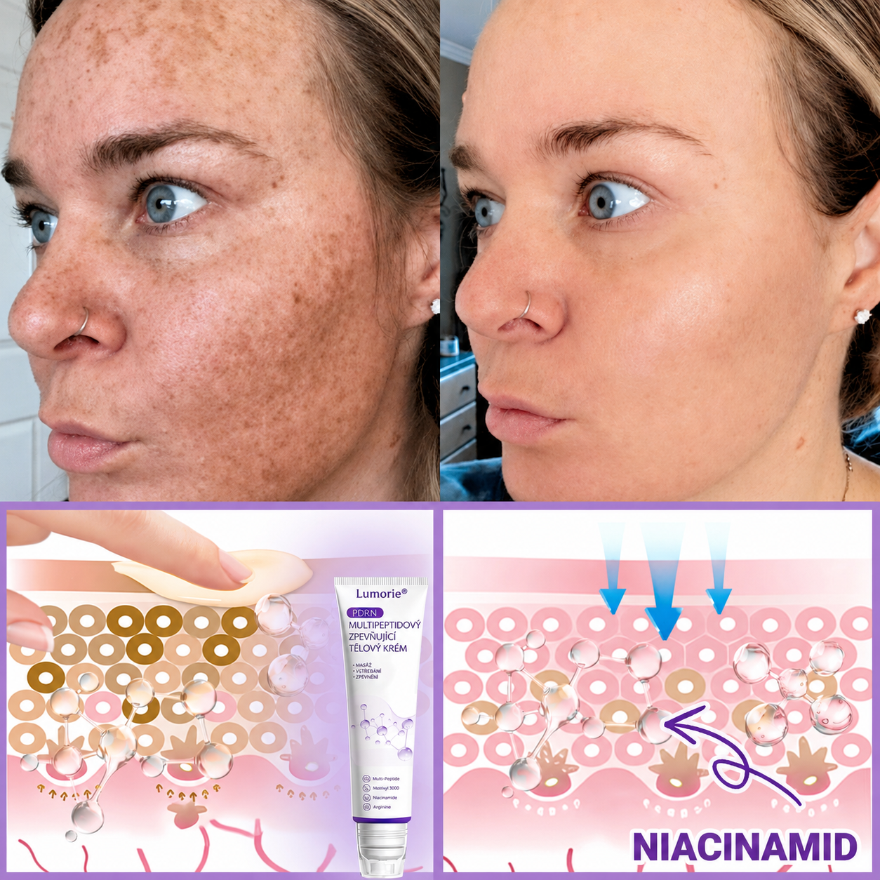 Doporučováno dermatology🥇 | 🍗𝐋𝐮𝐦𝐨𝐫𝐢𝐞® PDRN Multi-Peptidový masážní tělový krém – Proti stárnutí, hydratační, zpevňující, regenerační, sjednocující, proti akné a skvrnám, na odstraňování bradavic a mateřských znamének, pro úlevu při lupénce.❤️