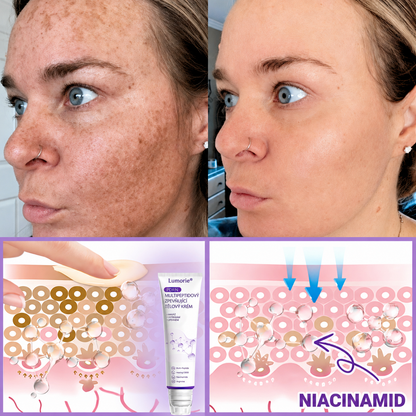 Doporučováno dermatology🥇 | 🍗𝐋𝐮𝐦𝐨𝐫𝐢𝐞® PDRN Multi-Peptidový masážní tělový krém – Proti stárnutí, hydratační, zpevňující, regenerační, sjednocující, proti akné a skvrnám, na odstraňování bradavic a mateřských znamének, pro úlevu při lupénce.❤️