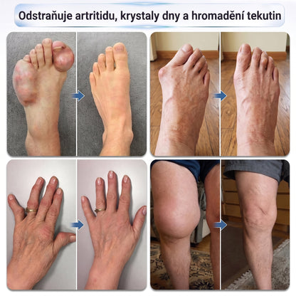 OFICIÁLNÍ OBCHOD | IFMAGIC® 0,05 mm Mikroneedle Rychle Působící Roll-On pro Úlevu Kloubů a Kostí🎇