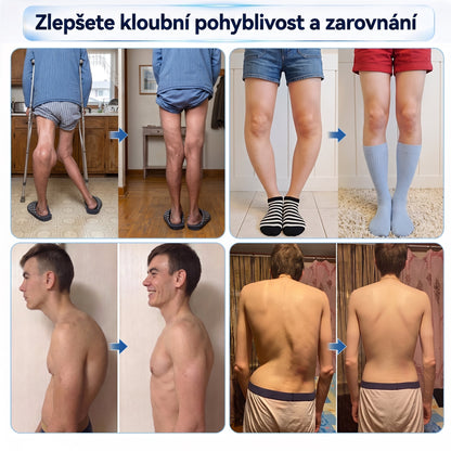 OFICIÁLNÍ OBCHOD | IFMAGIC® 0,05 mm Mikroneedle Rychle Působící Roll-On pro Úlevu Kloubů a Kostí🎇