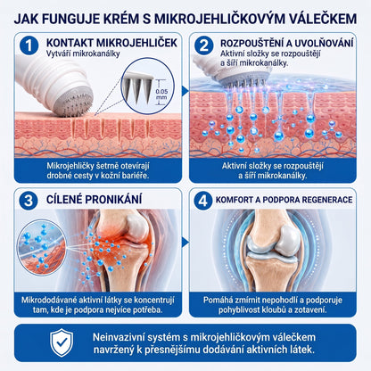 OFICIÁLNÍ OBCHOD | IFMAGIC® 0,05 mm Mikroneedle Rychle Působící Roll-On pro Úlevu Kloubů a Kostí🎇