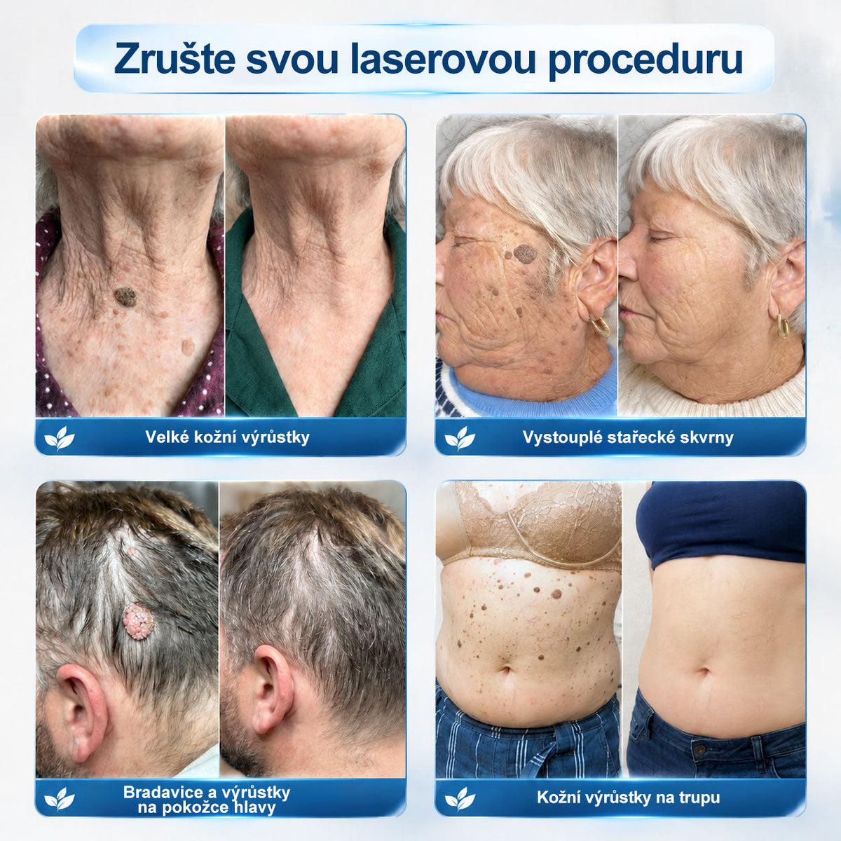 Oficjalny sklep marki |👩‍⚕️𝐏𝐢𝐜𝑑𝑜® 𝟕-𝐝𝐧𝐢𝐨𝐰𝐲 𝐤𝐨𝐫𝐞𝐤𝐭𝐨𝐫 𝐩𝐥𝐚𝐦 𝐢 𝐩𝐫𝐳𝐞𝐛𝐚𝐫𝐰𝐢𝐞ń (Bezbolesny aplikator kulkowy, bez blizn)✈️