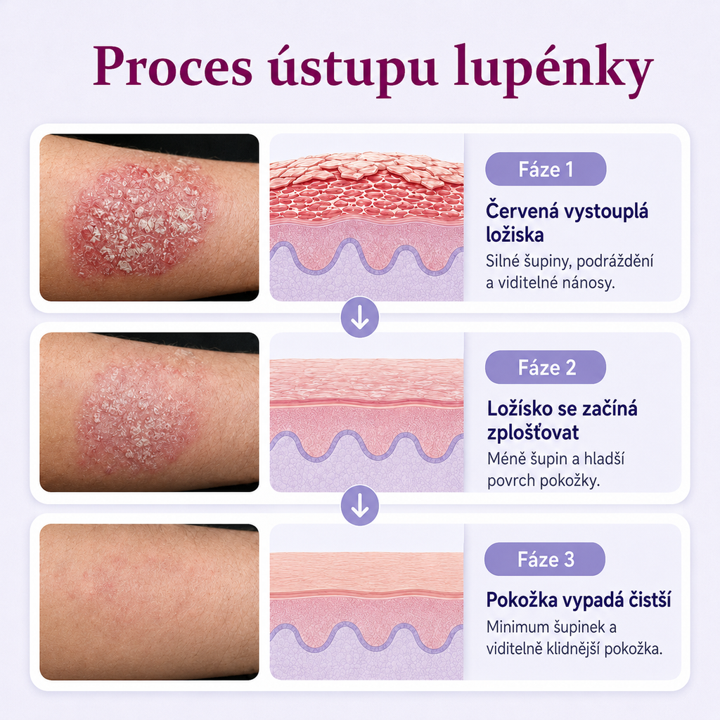 Krem regenerujący do skóry Ceoerty® DermaBloom
