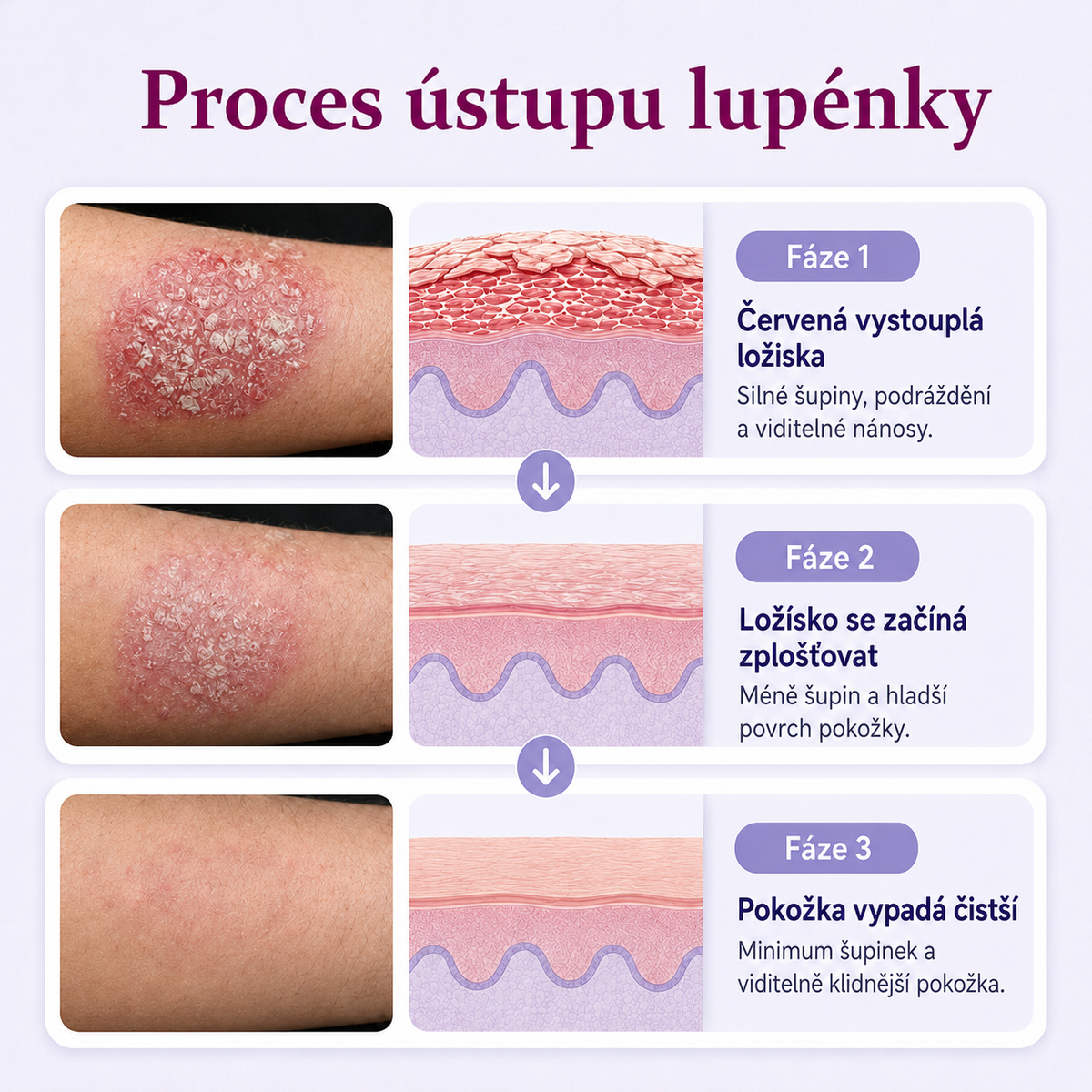 Krem regenerujący do skóry Ceoerty® DermaBloom