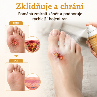Ceoerty® DermaVeil ochranný sprej na nohy