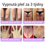 Doporučováno dermatology🥇 | 🍗𝐋𝐮𝐦𝐨𝐫𝐢𝐞® PDRN Multi-Peptidový masážní tělový krém – Proti stárnutí, hydratační, zpevňující, regenerační, sjednocující, proti akné a skvrnám, na odstraňování bradavic a mateřských znamének, pro úlevu při lupénce.❤️