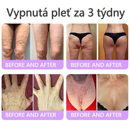 Doporučováno dermatology🥇 | 🍗𝐋𝐮𝐦𝐨𝐫𝐢𝐞® PDRN Multi-Peptidový masážní tělový krém – Proti stárnutí, hydratační, zpevňující, regenerační, sjednocující, proti akné a skvrnám, na odstraňování bradavic a mateřských znamének, pro úlevu při lupénce.❤️