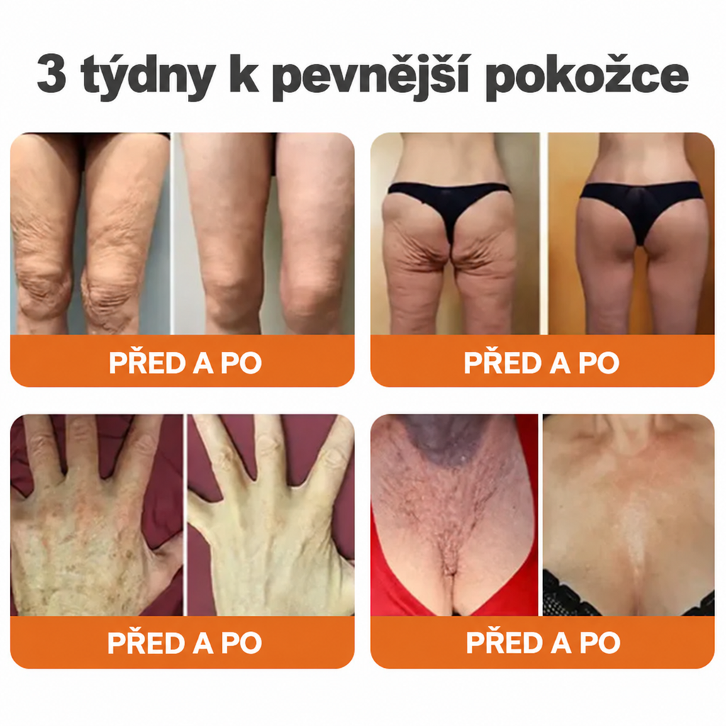 💎Oficjalna marka – ulepszona edycja Black & Gold | Rolimey® Bee Venom Pro Comprehensive Cream – krem ujędrniający do różnych typów skóry