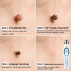 Oficjalny sklep marki |👩‍⚕️𝐏𝐢𝐜𝑑𝑜® 𝟕-𝐝𝐧𝐢𝐨𝐰𝐲 𝐤𝐨𝐫𝐞𝐤𝐭𝐨𝐫 𝐩𝐥𝐚𝐦 𝐢 𝐩𝐫𝐳𝐞𝐛𝐚𝐫𝐰𝐢𝐞ń (Bezbolesny aplikator kulkowy, bez blizn)✈️