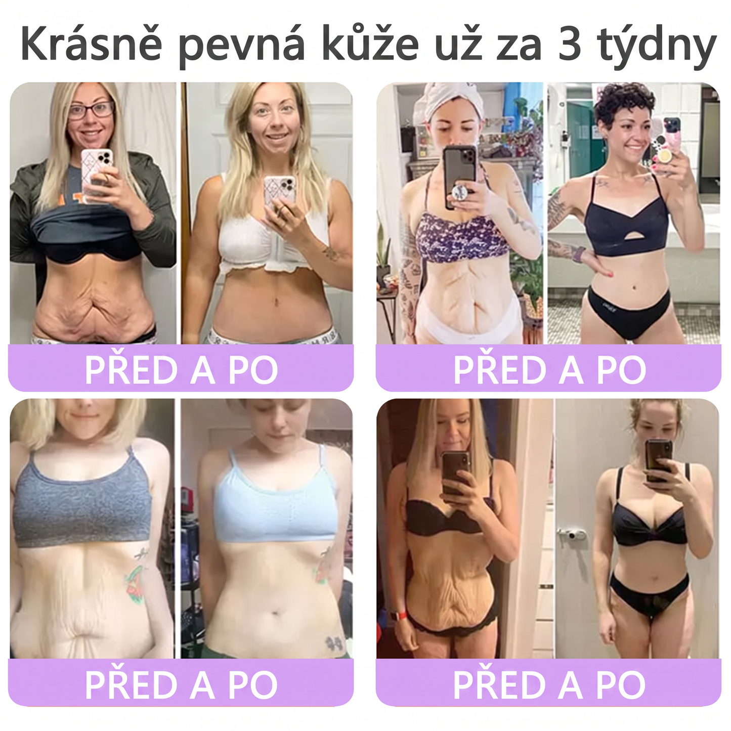 Doporučováno dermatology🥇 | 🍗𝐋𝐮𝐦𝐨𝐫𝐢𝐞® PDRN Multi-Peptidový masážní tělový krém – Proti stárnutí, hydratační, zpevňující, regenerační, sjednocující, proti akné a skvrnám, na odstraňování bradavic a mateřských znamének, pro úlevu při lupénce.❤️