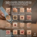Oficjalny sklep marki |👩‍⚕️𝐏𝐢𝐜𝑑𝑜® 𝟕-𝐝𝐧𝐢𝐨𝐰𝐲 𝐤𝐨𝐫𝐞𝐤𝐭𝐨𝐫 𝐩𝐥𝐚𝐦 𝐢 𝐩𝐫𝐳𝐞𝐛𝐚𝐫𝐰𝐢𝐞ń (Bezbolesny aplikator kulkowy, bez blizn)✈️