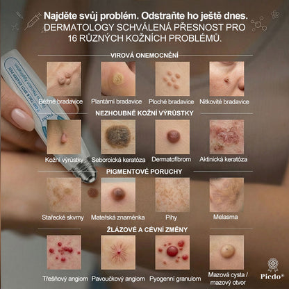 Oficiální značkový obchod |🌻𝐏𝐢𝐜𝑑𝑜® 𝟩𝖽𝖾𝗻𝗻í 𝘰𝘥𝘴𝘵𝗋𝖺ň𝗈𝗏𝖺č 𝒔𝒌𝒗𝒓𝙣 𝙖 𝙥𝙞𝙜𝙢𝙚𝙣𝙩𝘰𝘷ý𝘤𝘩 𝘴𝘬𝖛𝖗𝖓 (Bezbolestný rollerball bez jizev)