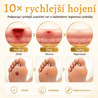 Ceoerty® DermaVeil ochranný sprej na nohy