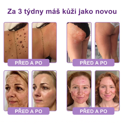 Doporučováno dermatology🥇 | 🍗𝐋𝐮𝐦𝐨𝐫𝐢𝐞® PDRN Multi-Peptidový masážní tělový krém – Proti stárnutí, hydratační, zpevňující, regenerační, sjednocující, proti akné a skvrnám, na odstraňování bradavic a mateřských znamének, pro úlevu při lupénce.❤️
