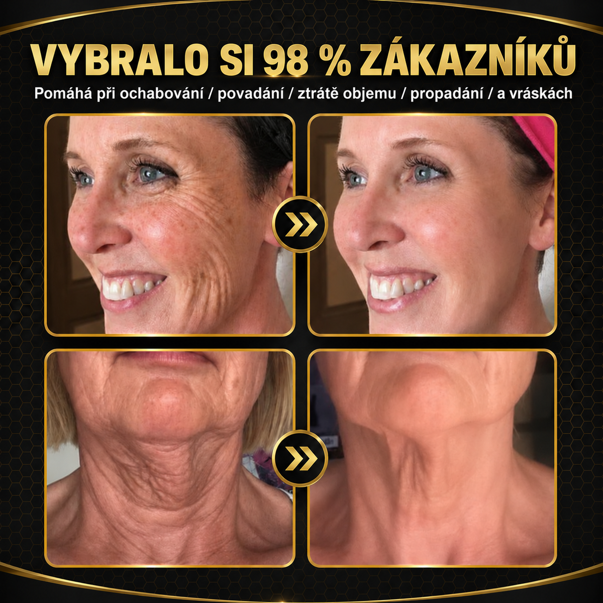 💎Oficjalna marka – ulepszona edycja Black & Gold | Rolimey® Bee Venom Pro Comprehensive Cream – krem ujędrniający do różnych typów skóry