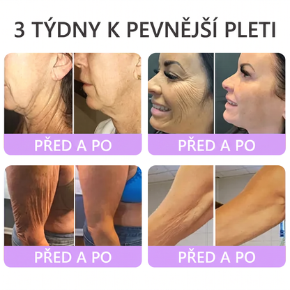 Doporučováno dermatology🥇 | 🍗𝐋𝐮𝐦𝐨𝐫𝐢𝐞® PDRN Multi-Peptidový masážní tělový krém – Proti stárnutí, hydratační, zpevňující, regenerační, sjednocující, proti akné a skvrnám, na odstraňování bradavic a mateřských znamének, pro úlevu při lupénce.❤️