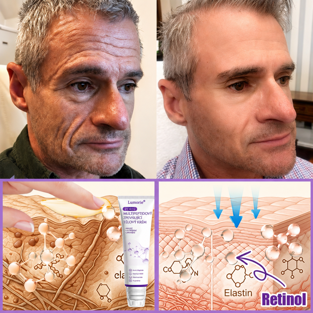 Doporučováno dermatology🥇 | 🍗𝐋𝐮𝐦𝐨𝐫𝐢𝐞® PDRN Multi-Peptidový masážní tělový krém – Proti stárnutí, hydratační, zpevňující, regenerační, sjednocující, proti akné a skvrnám, na odstraňování bradavic a mateřských znamének, pro úlevu při lupénce.❤️