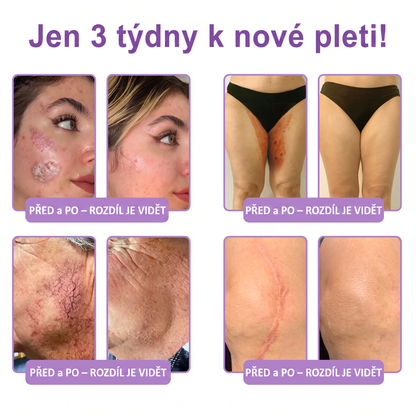 Doporučováno dermatology🥇 | 🍗𝐋𝐮𝐦𝐨𝐫𝐢𝐞® PDRN Multi-Peptidový masážní tělový krém – Proti stárnutí, hydratační, zpevňující, regenerační, sjednocující, proti akné a skvrnám, na odstraňování bradavic a mateřských znamének, pro úlevu při lupénce.❤️