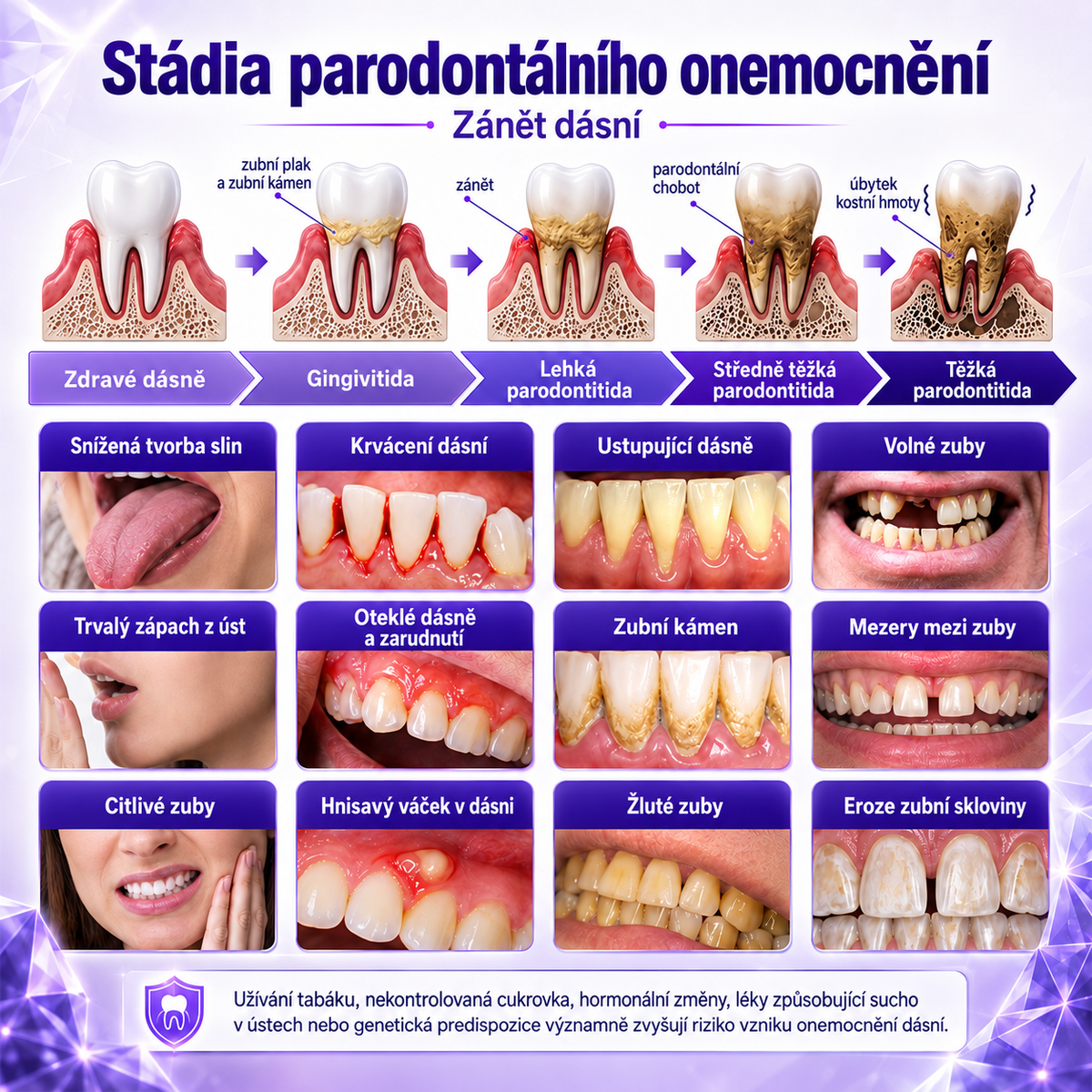 Pasta do zębów Ceoerty®🦷 do leczenia stanów zapalnych dziąseł i przyzębia