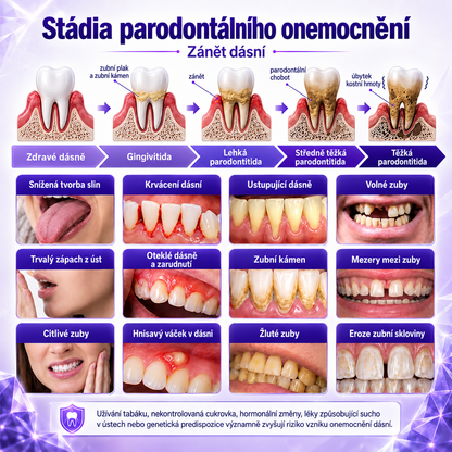Zubní pasta Ceoerty®🦷 pro léčbu zánětu dásní a parodontu