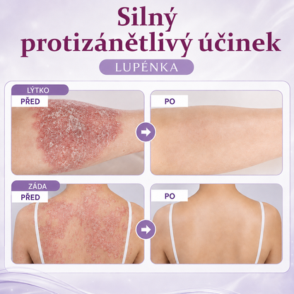 Krém na regeneraci pleti Ceoerty® DermaBloom