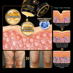 💎Oficjalna marka – ulepszona edycja Black & Gold | Rolimey® Bee Venom Pro Comprehensive Cream – krem ujędrniający do różnych typów skóry