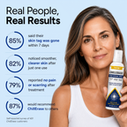 ChillErase produktový vizuál
