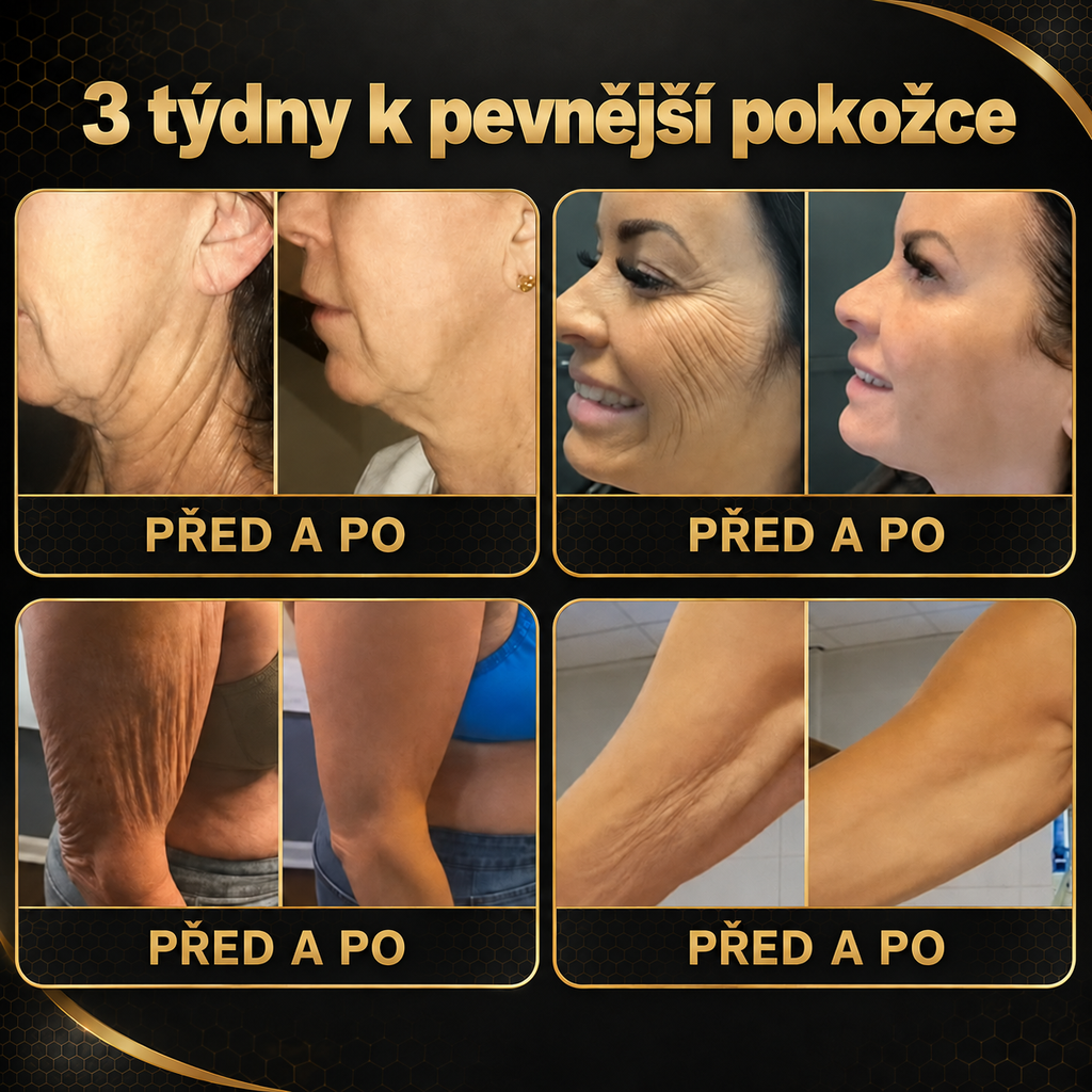 💎Oficjalna marka – ulepszona edycja Black & Gold | Rolimey® Bee Venom Pro Comprehensive Cream – krem ujędrniający do różnych typów skóry