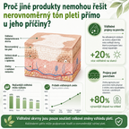 Ceoerty® 🌵Ziołowy krem na bielactwo