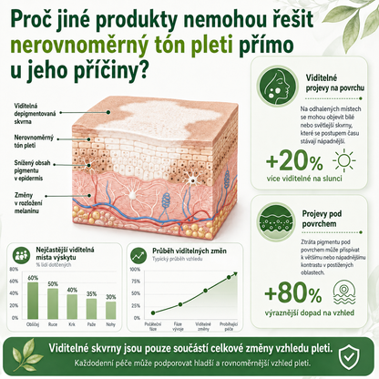 Ceoerty® 🌵Bylinný krém na vitiligo