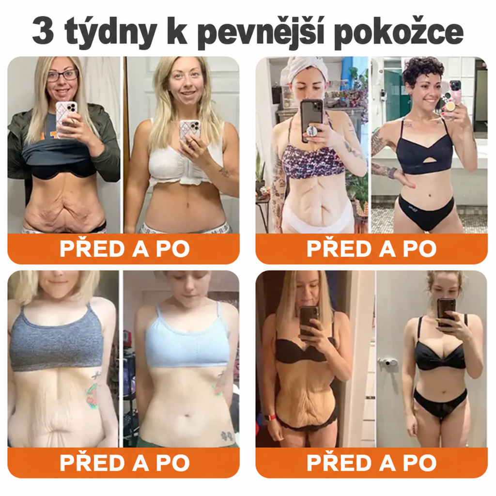 💎Oficjalna marka – ulepszona edycja Black & Gold | Rolimey® Bee Venom Pro Comprehensive Cream – krem ujędrniający do różnych typów skóry