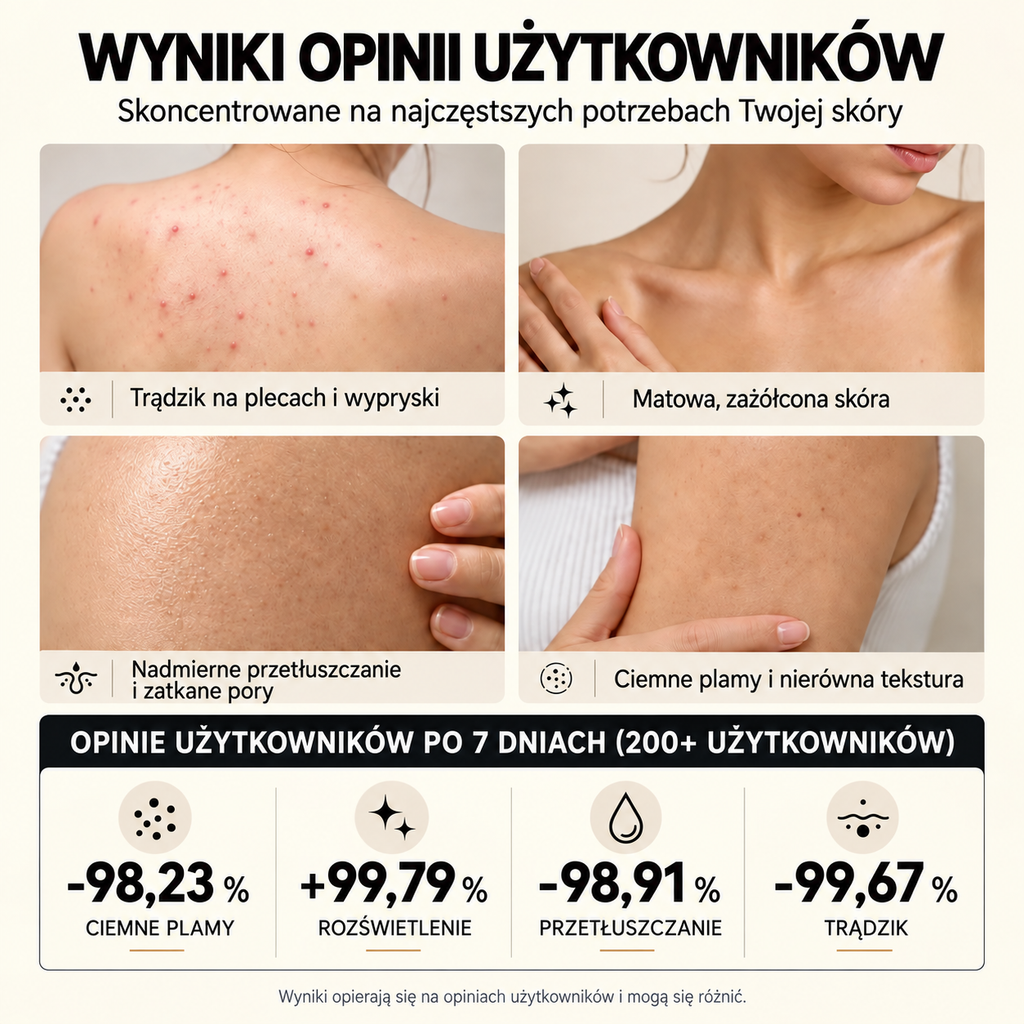 PL🥭Mydło z niacynamidem rozjaśniające skórę – na ostudę, ciemne plamy i piegi