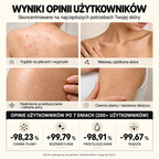 PL🥭Mydło z niacynamidem rozjaśniające skórę – na ostudę, ciemne plamy i piegi