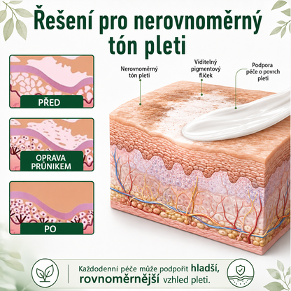 Ceoerty® 🌵Bylinný krém na vitiligo