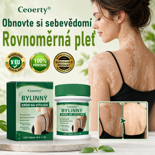 Ceoerty® 🌵Bylinný krém na vitiligo